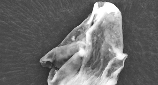 英謝菲爾德大學的研究人員在探空氣球中采集樣本中發(fā)現(xiàn)了硅藻屬植物